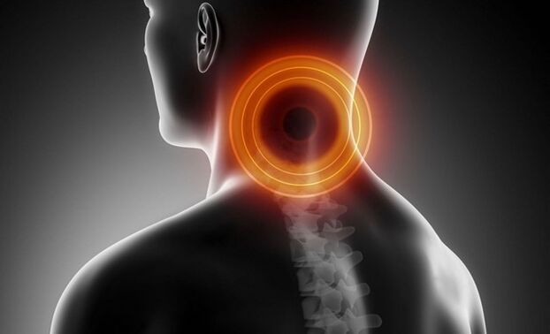 cervicalgia con osteocondrosis cervical