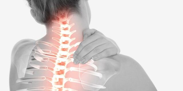 dolor de cuello debido a la osteocondrosis